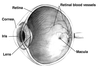 Macular Holes: How They Are Caused and Treated