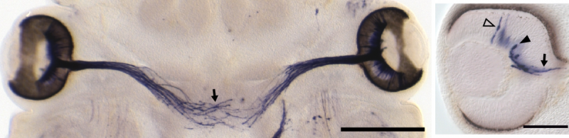 Microscope image of embyonic retinal ganglion cells