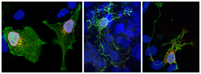 Stained microscope images of CEK293 cells overexpressing Brn3 transcriptional target genes