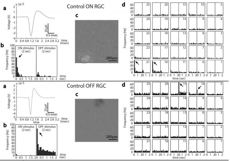 Diagram comparing attributes of "ON" and "OFF" retinal ganglion cells